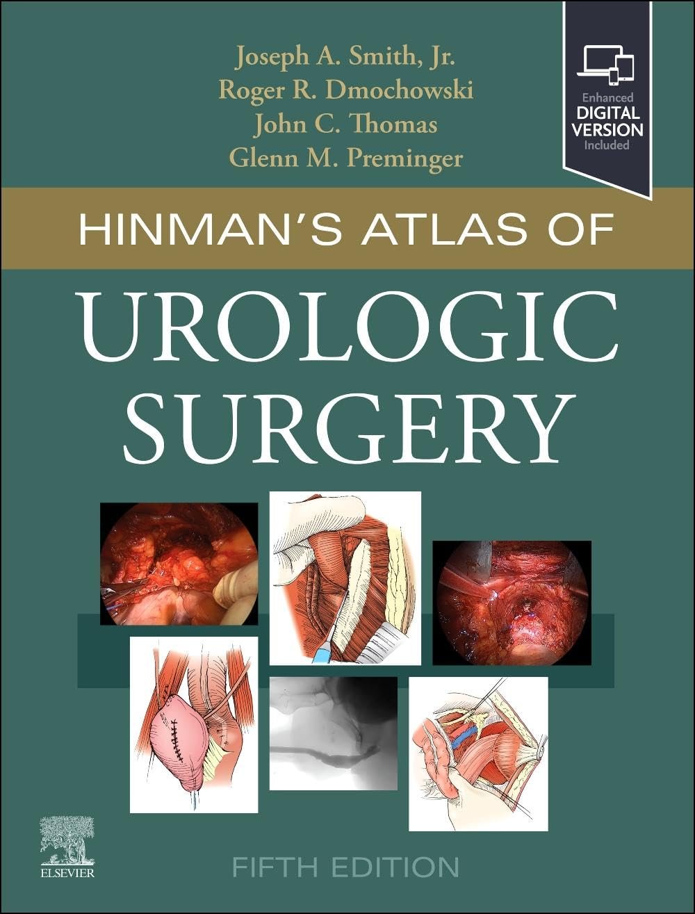 Hinman’s Atlas of Urologic Surgery